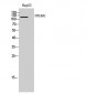 COL9A1 Polyclonal Antibody